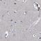 Aminoacylase 3 antibody, NBP1-89256, Novus Biologicals, Immunohistochemistry paraffin image 