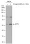 Interferon Induced Protein With Tetratricopeptide Repeats 1 antibody, GTX118713, GeneTex, Western Blot image 