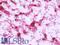 NADH:Ubiquinone Oxidoreductase Core Subunit V2 antibody, LS-B9848, Lifespan Biosciences, Immunohistochemistry paraffin image 