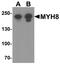 Myosin Heavy Chain 8 antibody, PA5-72846, Invitrogen Antibodies, Western Blot image 