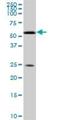 Retinoid X Receptor Alpha antibody, H00006256-M05, Novus Biologicals, Western Blot image 