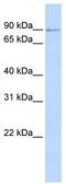 Zinc Finger Protein 263 antibody, TA329294, Origene, Western Blot image 