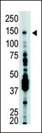 Ubiquitin Specific Peptidase 7 antibody, 61-101, ProSci, Western Blot image 