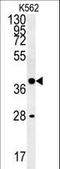 Wnt Family Member 8B antibody, LS-C160637, Lifespan Biosciences, Western Blot image 