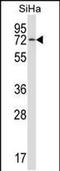 Heat Shock Protein Family A (Hsp70) Member 12B antibody, PA5-48597, Invitrogen Antibodies, Western Blot image 