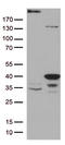 General Transcription Factor IIH Subunit 3 antibody, LS-C796444, Lifespan Biosciences, Western Blot image 