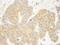 Growth Factor Receptor Bound Protein 10 antibody, NB100-88153, Novus Biologicals, Immunohistochemistry paraffin image 