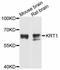 Keratin 1 antibody, abx126069, Abbexa, Western Blot image 