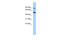 Calpain 10 antibody, 26-646, ProSci, Western Blot image 