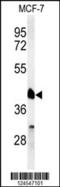 Retinoid X Receptor Alpha antibody, 61-713, ProSci, Western Blot image 