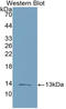 C-C motif chemokine 16 antibody, LS-C314702, Lifespan Biosciences, Western Blot image 