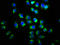 Dishevelled Segment Polarity Protein 2 antibody, LS-C375617, Lifespan Biosciences, Immunofluorescence image 