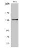 Integrin Subunit Alpha V antibody, STJ93730, St John