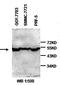 ST13 Hsp70 Interacting Protein antibody, orb77350, Biorbyt, Western Blot image 