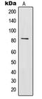 Interleukin-31 receptor subunit alpha antibody, LS-C353630, Lifespan Biosciences, Western Blot image 