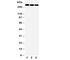 ATP Binding Cassette Subfamily A Member 1 antibody, R30941, NSJ Bioreagents, Western Blot image 