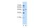 Semenogelin 1 antibody, PA5-42098, Invitrogen Antibodies, Western Blot image 