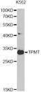 Thiopurine S-Methyltransferase antibody, STJ25944, St John