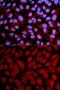 Calcium/Calmodulin Dependent Serine Protein Kinase antibody, GTX53920, GeneTex, Immunofluorescence image 