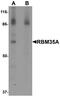 Epithelial Splicing Regulatory Protein 1 antibody, A06068, Boster Biological Technology, Western Blot image 