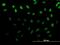 ZFP69 Zinc Finger Protein B antibody, H00065243-B01P, Novus Biologicals, Immunocytochemistry image 