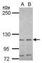 Heat Shock Protein Family A (Hsp70) Member 4 antibody, GTX112607, GeneTex, Western Blot image 