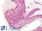 ABL Proto-Oncogene 1, Non-Receptor Tyrosine Kinase antibody, LS-B11050, Lifespan Biosciences, Immunohistochemistry frozen image 