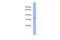 Chromosome 17 Open Reading Frame 78 antibody, PA5-44393, Invitrogen Antibodies, Western Blot image 