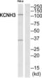 Potassium Voltage-Gated Channel Subfamily H Member 3 antibody, abx014732, Abbexa, Western Blot image 