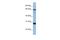 Mediator of RNA polymerase II transcription subunit 4 antibody, A06467, Boster Biological Technology, Western Blot image 