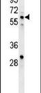 IKAROS Family Zinc Finger 1 antibody, PA5-23728, Invitrogen Antibodies, Western Blot image 