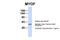 Myoferlin antibody, NBP1-59396, Novus Biologicals, Western Blot image 