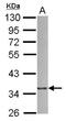 Actin Related Protein 2/3 Complex Subunit 1B antibody, NBP2-15264, Novus Biologicals, Western Blot image 