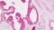 CD11C antibody, PA5-32886, Invitrogen Antibodies, Immunohistochemistry paraffin image 