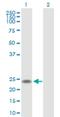 IGF Like Family Receptor 1 antibody, H00199746-B01P, Novus Biologicals, Western Blot image 