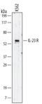 Interleukin-23 receptor antibody, MA5-23935, Invitrogen Antibodies, Western Blot image 