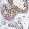 Proteasome 26S Subunit, Non-ATPase 13 antibody, NBP2-38426, Novus Biologicals, Immunohistochemistry frozen image 