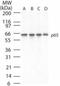 Mitochondrial E3 Ubiquitin Protein Ligase 1 antibody, NB100-56055, Novus Biologicals, Western Blot image 