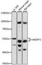 Angiopoietin 1 antibody, LS-C749999, Lifespan Biosciences, Western Blot image 