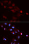 Small Nuclear Ribonucleoprotein Polypeptide E antibody, 19-697, ProSci, Immunofluorescence image 