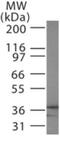 Microtubule Associated Protein RP/EB Family Member 3 antibody, GTX13859, GeneTex, Western Blot image 