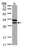 Electron Transfer Flavoprotein Subunit Beta antibody, PA5-22005, Invitrogen Antibodies, Western Blot image 