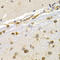 Eukaryotic Translation Elongation Factor 1 Delta antibody, LS-C332129, Lifespan Biosciences, Immunohistochemistry paraffin image 