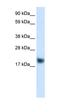 Cysteine And Glycine Rich Protein 3 antibody, orb329763, Biorbyt, Western Blot image 