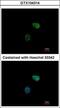 Proteasome 26S Subunit, ATPase 6 antibody, GTX104314, GeneTex, Immunocytochemistry image 