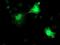 Regulatory Factor X Associated Ankyrin Containing Protein antibody, MA5-25862, Invitrogen Antibodies, Immunocytochemistry image 