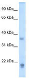 Growth Hormone 2 antibody, TA346316, Origene, Western Blot image 