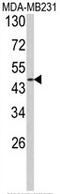 Adrenoceptor Alpha 2B antibody, AP17872PU-N, Origene, Western Blot image 