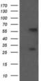Chaperonin Containing TCP1 Subunit 8 Like 2 antibody, NBP2-46105, Novus Biologicals, Western Blot image 