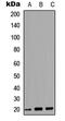 MARCKS Like 1 antibody, MBS829625, MyBioSource, Western Blot image 